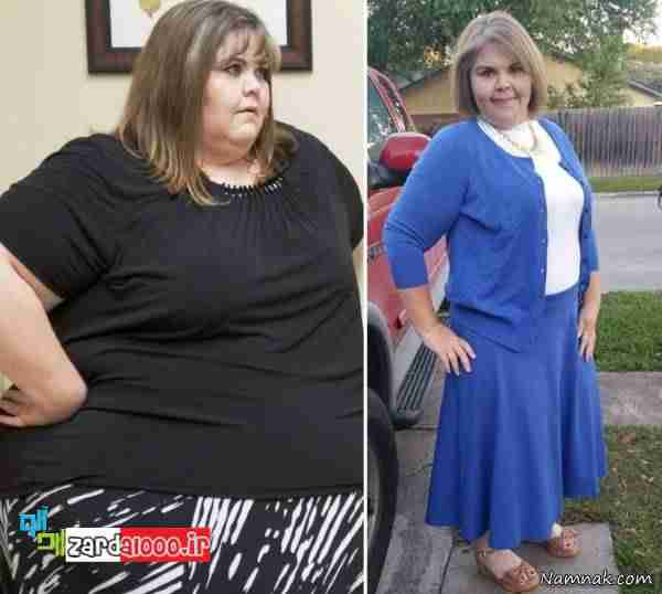 کاهش وزن عجیب و غیر قابل باور افراد چاق