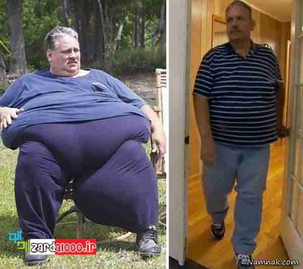 عکس های شگفت انگیز قبل و بعد کاهش وزن