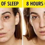 اثرات بی خوابی بر روی پوست
